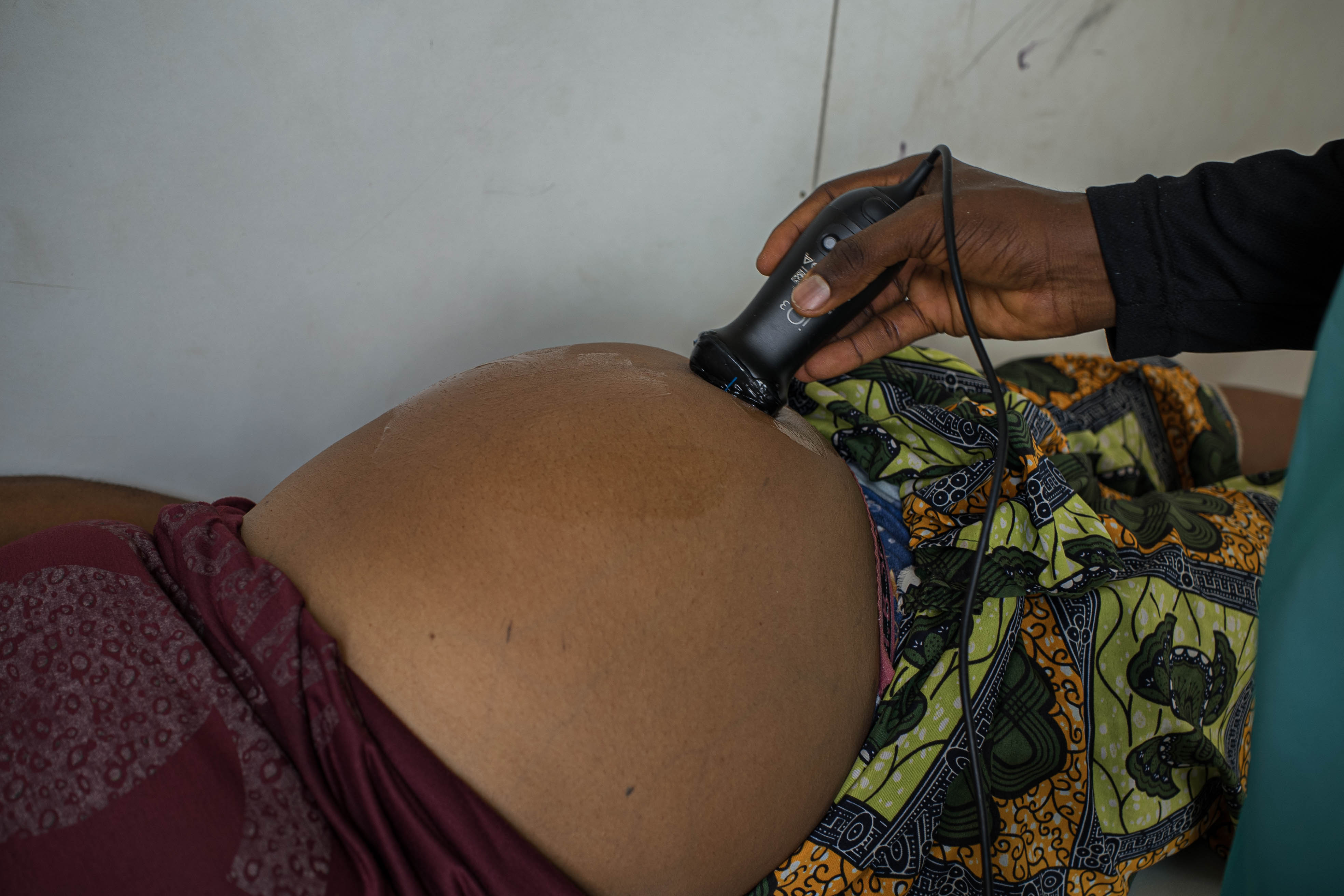 U-VOL Foundation and EHCON Equip Nigeria’s Maternal Workforce with Lifesaving Ultrasound Skills in Partnership with Butterfly Network